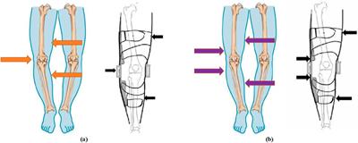 Design and evaluation of a wedge-shaped adaptive knee orthosis for the human lower limbs 